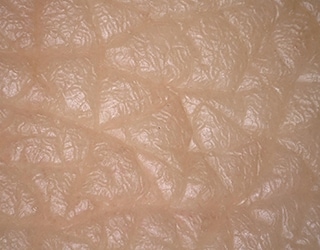 Multiverlichtingsbeeld van huidstructuur (huidreplica)