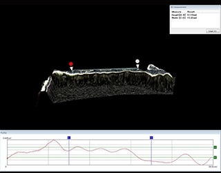 Měření 3D tvaru a profilu bioabsorbovatelného stentu
