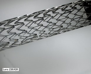 Bilderfassung eines Stents aus beliebigem Winkel (20x)