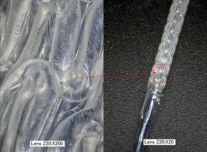 Vergrößerte Aufnahme eines bioresorbierbaren Stents (links: 200x / rechts: 20x)