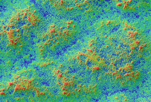 Observation et mesure de surfaces texturées au microscope numérique