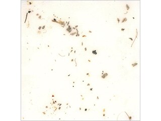 Avant comptage : Éclairage annulaire (50x)
