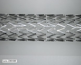 Capture d’image d’un stent selon un angle libre (20x)