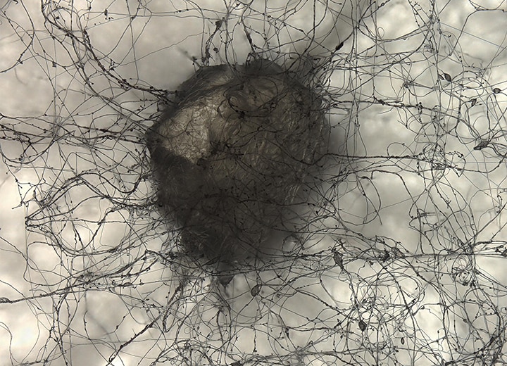 Éclairage par transmission (100x)