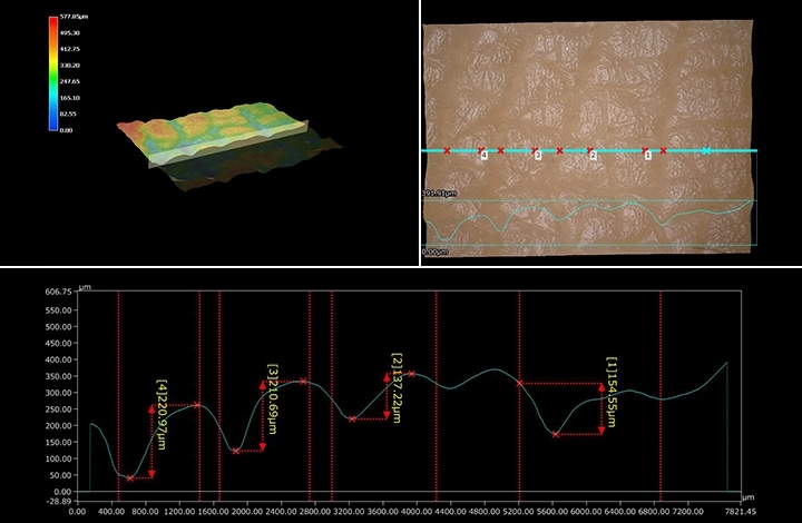 A bőrfelület 3D-s alakja és 3D-s profilja