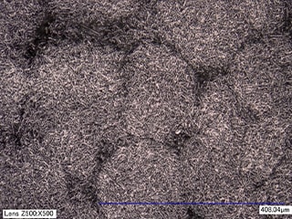 Pacemakerkomponens 3D-s megjelenítése (500×)