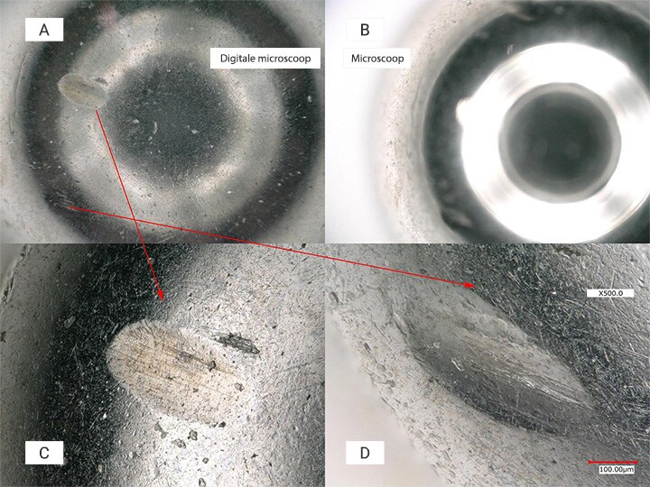 A: Waarneming met een digitale microscoop B: Waarneming met behulp van een microscoop C: Waarneming van een deuk in het voorste oppervlak D: Waarneming van een deuk in het achterste oppervlak (500×)
