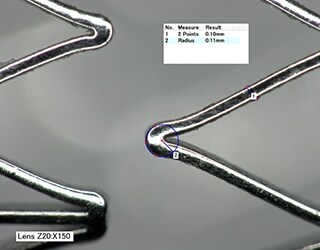 HDR-beeld van een stentstut en straalmeting van de buiging (150×)