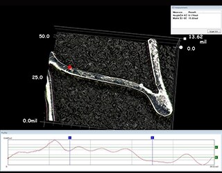 3D-vorm- en -profielmeting van een bioabsorbeerbare stent